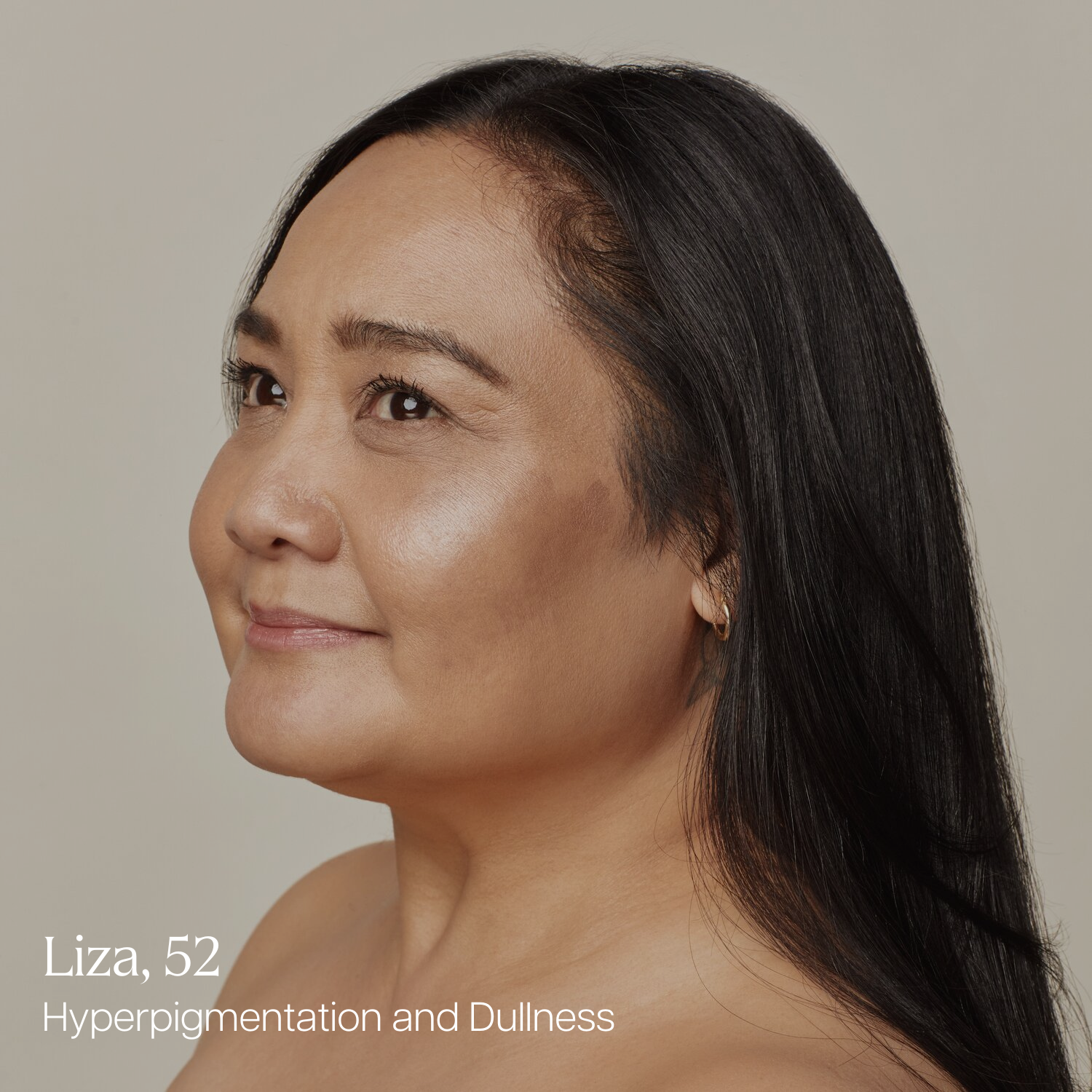 Portrait of Liza, 52, showing signs of hyperpigmentation and dull skin