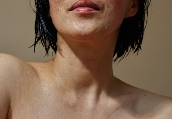 Woman with water droplets on her skin, showing redness and pigmentation before laser facial treatment at Skin Laundry UAE