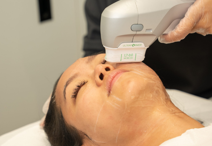 Woman receiving Ultrafomer III non-surgical skin tightening treatment at Skin Laundry UAE