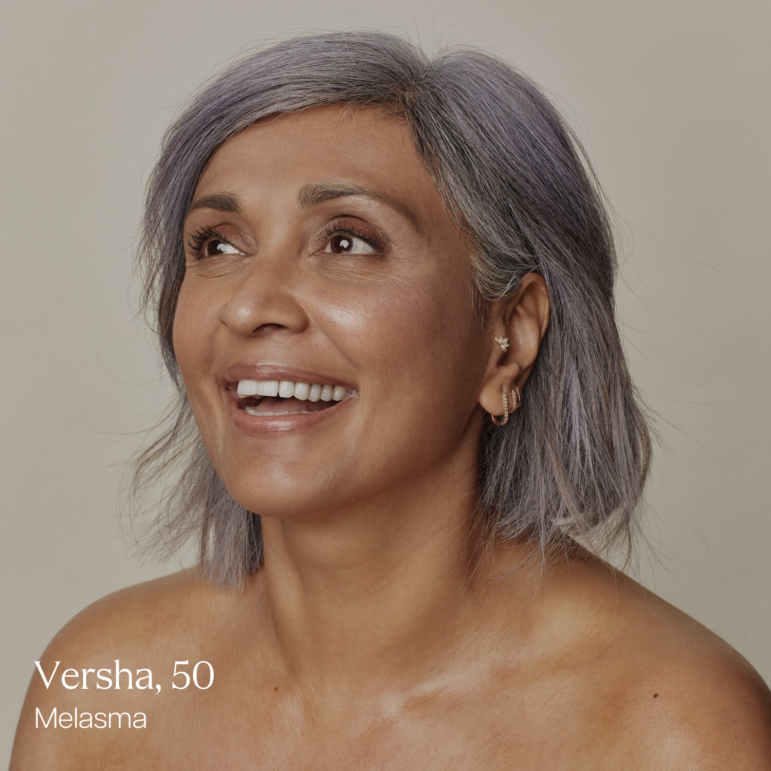 Versha, 50, smiling with radiant skin after treating melasma at Skin Laundry UAE